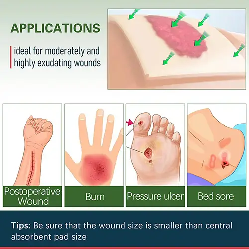 Calcium Alginate Wound Dressing 5